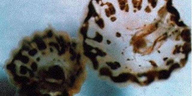 This microscopic image shows adult thimble jellyfish or sea lice.