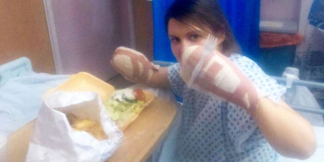 Mom Has Arm Fingers Both Legs Cut Off After Doctors Failed To Spot