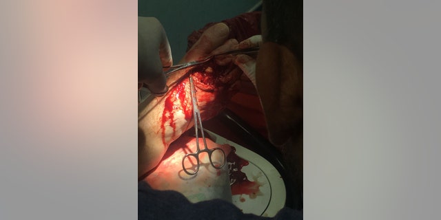 Doctors stitched Newman's tendons back together after the horrific attack