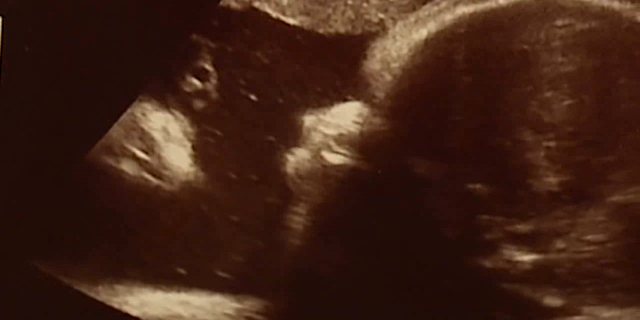 A Pennsylvania couple said they think they saw Jesus in their baby daughter’s sonogram just days before giving birth.