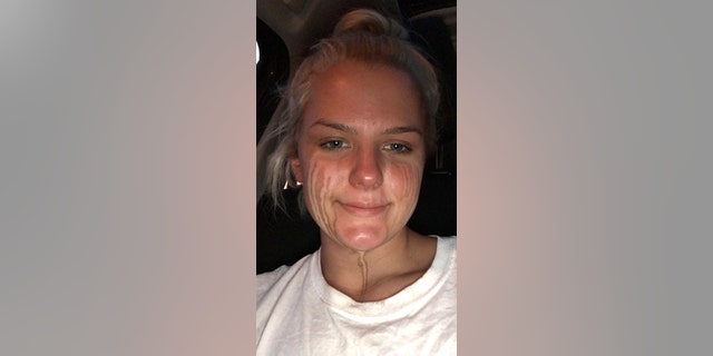 Alex Vinklarek said she was watching heartwarming Twitter videos that made her cry, which made the tan streak.