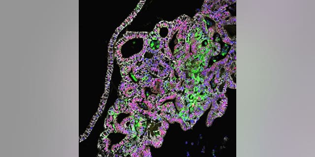 This confocal microscopic image shows tissue-engineered human stomach tissues from the corpus/fundus region, which produce acid and digestive enzymes. 