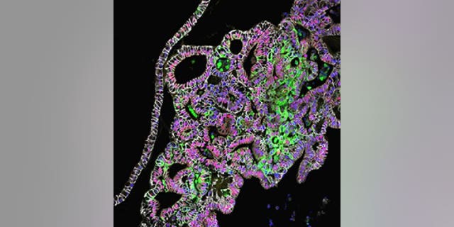 This confocal microscopic image shows tissue-engineered human stomach tissues from the corpus/fundus region, which produce acid and digestive enzymes.