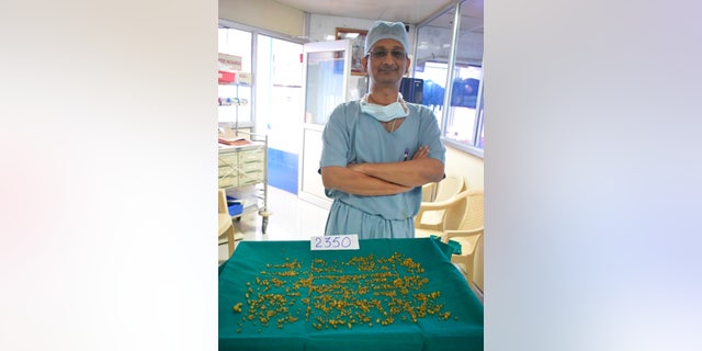 Dr. Bimal C. Shah successfully removed 2,350 gallstones from the woman, “Gallstones, measuring up to 10 to 12 millimeters were removed through surgery which lasted about 30 minutes.”