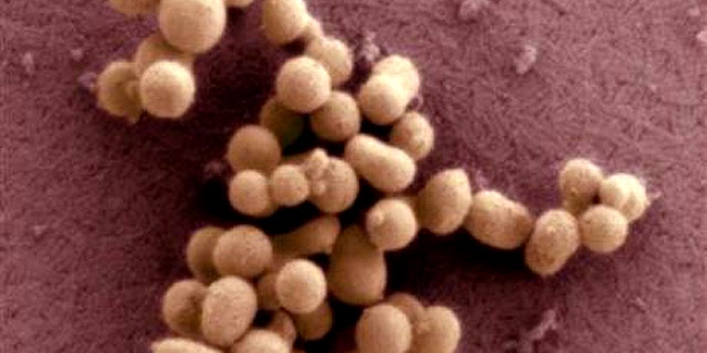 A scanning electron micrograph image of the synthetic bacteria of M. mycoides JCVI-syn1.