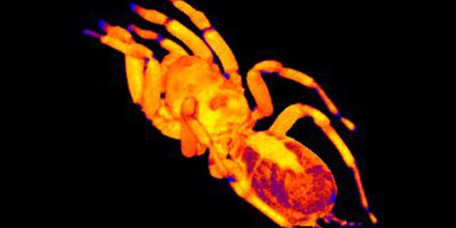 An MRI of a trantula suggests the heart -- seen is in the spider's abdomen, shown here as an elongated yellow region -- may have a peculiar "double beat."