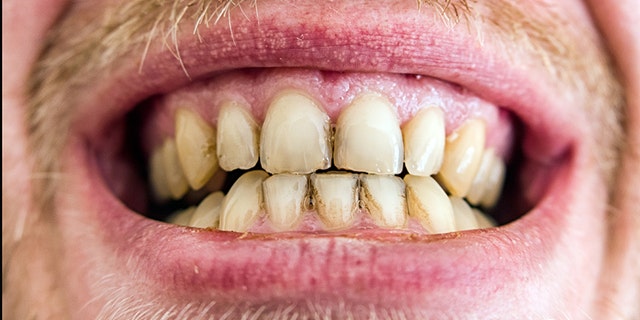 Many of those polled said they would rather face their fears of public speaking than take a seat in the dentist’s chair.
