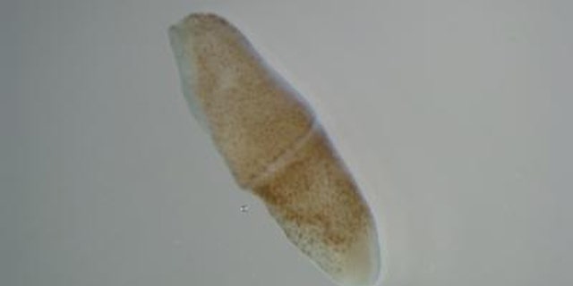 Tiny worms such as these may have giant implications for the entire animal kingdom, scientists say.