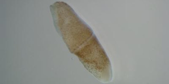 Tiny worms such as these may have giant implications for the entire animal kingdom, scientists say.