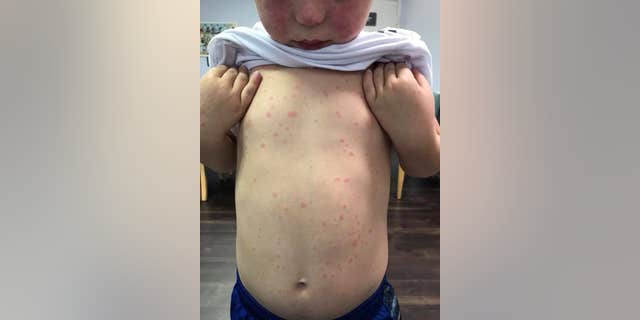 Mason's mom Danielle wrote on Facebook that her son is now "completely healthy."