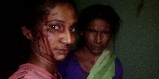 Rupali Meshram takes a photo of her and her mother, Jijabhai, following a fight with a tiger.