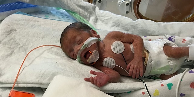 Doctors said survival rate for Markcus was 50 percent.