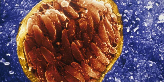 This is a scanning electron micrograph of the protozoan parasite Toxoplasma gondii, tissue cyst in brain of an infected mouse.
