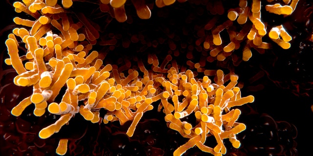 Tuberculosis is an infectious disease caused by the bacterium Mycobacterium tuberculosis. In 90 % of cases it affects the lungs. Symptons of tuberculosiss are blood-containing sputum, fever, night sweats and weight loss.