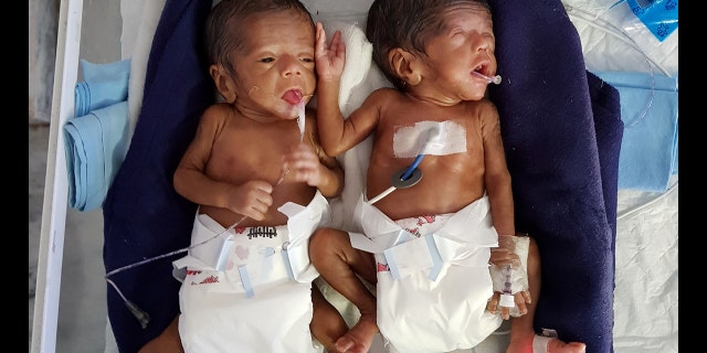 Micro Preemie Twin Babies Born At 24 Weeks Weighing 1 3 Pounds Fox News