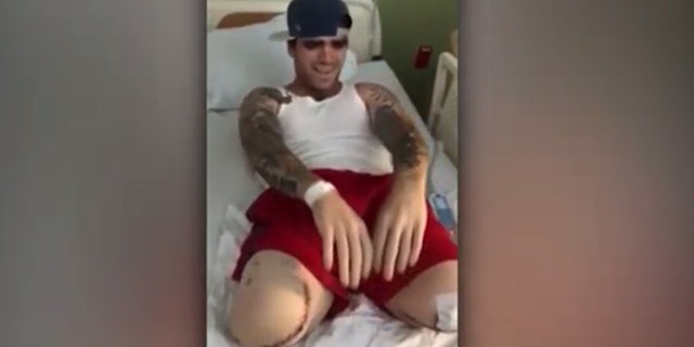 Brendan Brock lost both of his legs after being struck by a car while helping an Uber driver push his vehicle off a highway, a new lawsuit states.