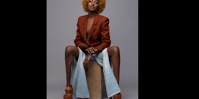 Berlange battled through her insecurity and went on to prove the bullies wrong by modeling for brands including Toys R Us, Samsung, Mac and Johnnie Walker.