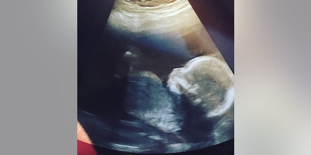 The couple's unborn child, seen above, was also killed in the crash.