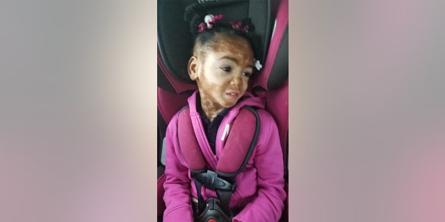 Aria Ellison was diagnosed with cerebral palsy at 16 months, when her mother noticed she was missing developmental milestones.