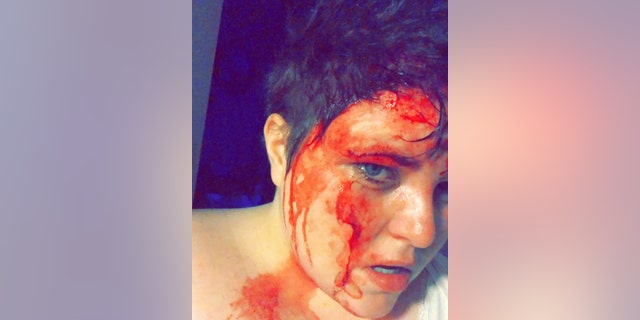 Amnell-Connor said she woke up at 4 am covered in blood and called for her dad.