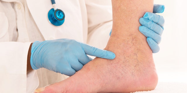 Lower limb vascular examination