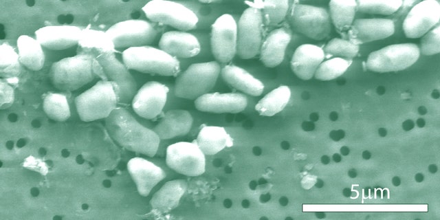 A scanning-electron micrograph image of arsenic-eating bacteria, which NASA says has redefined the quest for life in the universe.