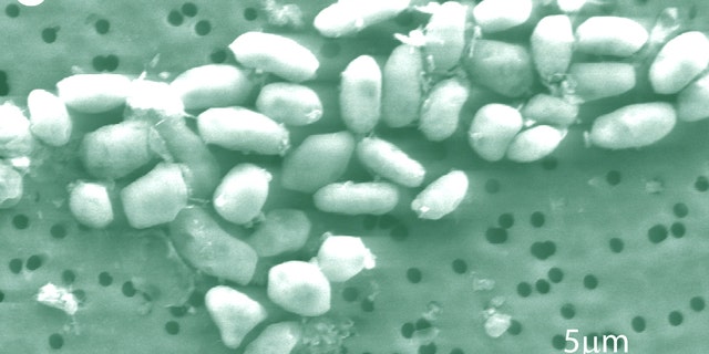 A scanning-electron micrograph image of arsenic-eating bacteria, which NASA says has redefined the quest for life in the universe.