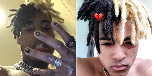 Rapper XXXTentacion died on June 18 after a shooting. He was 20.
