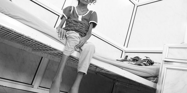 Hodeida, Yemen (30 April 2017). Jamila Ali Abdu Qasem, 7-year-old girl sick with malnutrition and intestinal worms photographed here two days before she died at the Al Thawra Public Hospital in Hodeidah. From the nothern Yemeni province of Hajjah, Jamila's parents were unable to pay for her transportation fees to Sana'a in order to get proper diagnosis and treatment for her condition. Hundreds of children in Yemen die everyday from preventable diseases and conditions. @ICRC/Ralph El Hage