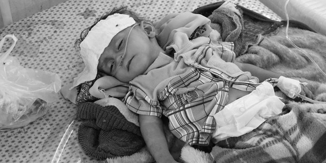 Hodeida, Yemen. (2 May 2017). Little boy lies on a bed at the Al Thawra Public Hospital in Hodeida. Due to lack of proper medical care in nearby provinces, people have no choice, but to come to this hospital in Hodeida, which deals with over 1000 newcomers everyday. @ICRC/Ralph El Hage
