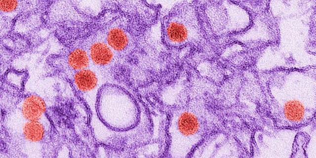 FILE - This 2016 digitally-colorized electron microscope image made available by the Centers for Disease Control and Prevention shows the Zika virus, in red, about 40 nanometers in diameter. On Friday, Aug. 26, 2016, U.S. health officials reported the first case of Zika spread through sex by a man who had no symptoms of the disease. In other cases of sexual transmission, the virus was spread by someone who at some point had symptoms. The Maryland man went to the Dominican Republic, where there is a Zika outbreak. He didnt get sick but his sex partner did and recovered. (Cynthia Goldsmith/CDC via AP)