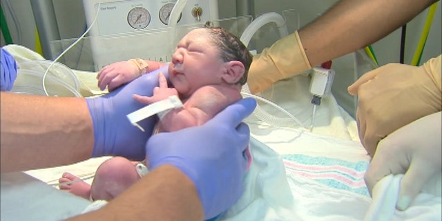 The baby, who was born via emergency C-section Tuesday, has been diagnosed with microcephaly
