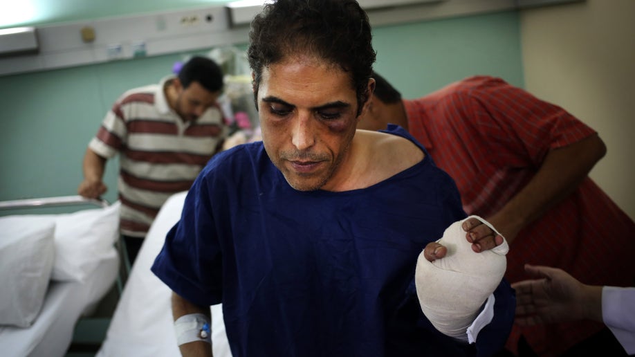 cb482e92-Mideast Egypt Politician Attacked