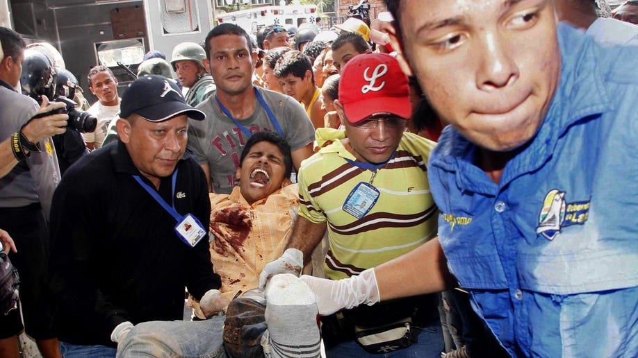 5447b972-APTOPIX  Venezuela Prison Violence