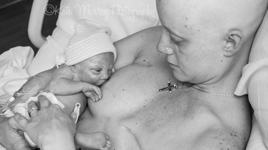 Photos Of Mother With Cancer Breastfeeding After Single Mastectomy Go