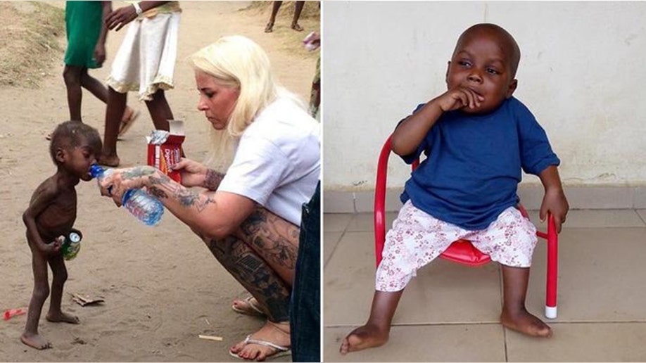 Starving toddler from viral photo thriving after rescue Fox News