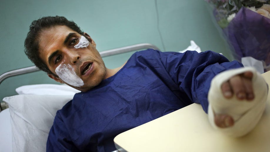 Mideast Egypt Politician Attacked