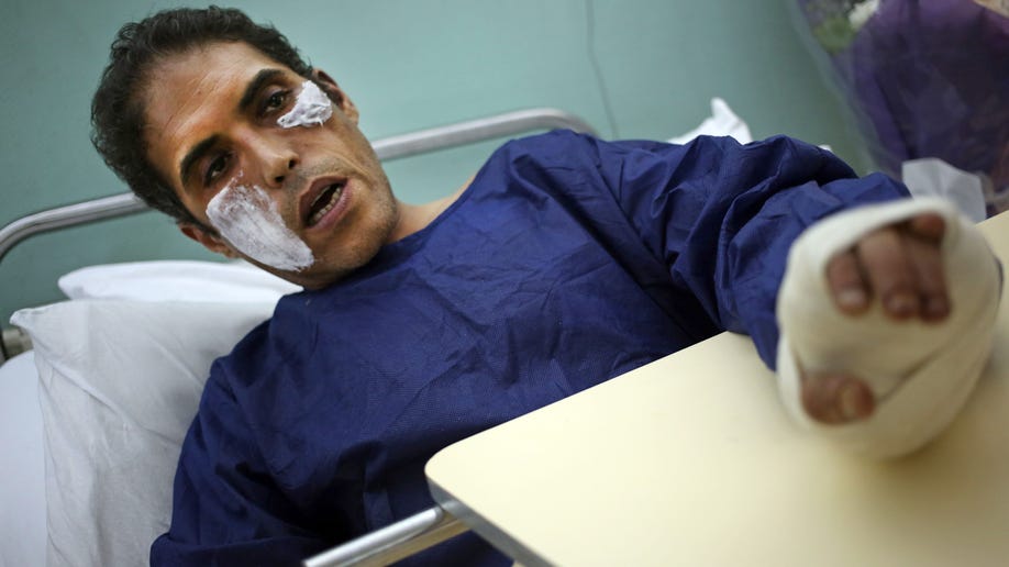 Mideast Egypt Politician Attacked