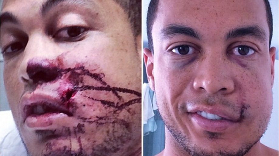 Marlins' Giancarlo Stanton releases first photos after fastball to fac...