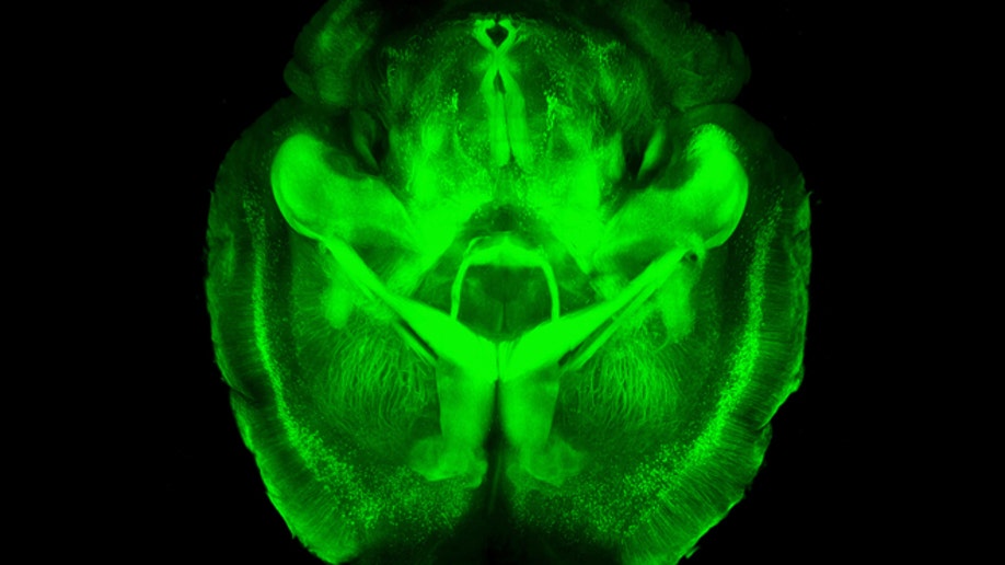 0f338e12-Transparent Brains