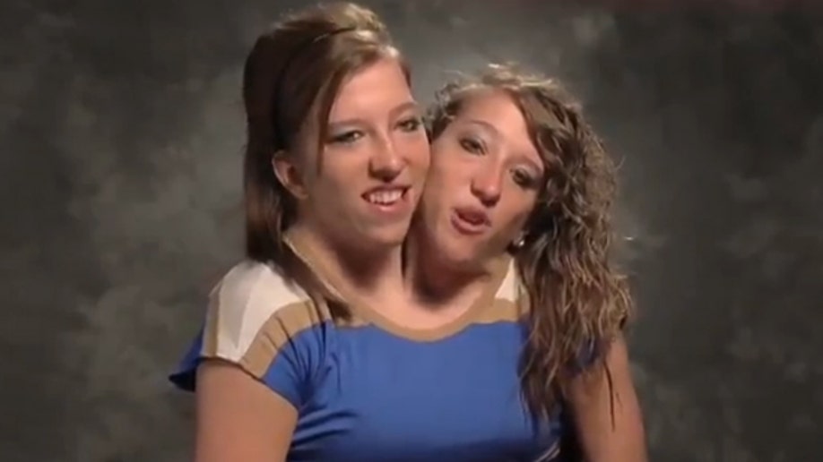 640_HenselTwins