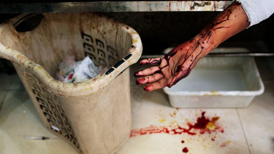 Mideast Syria Brutal War