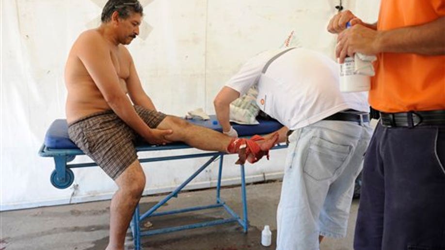 81b42857-Argentina Fish Attack