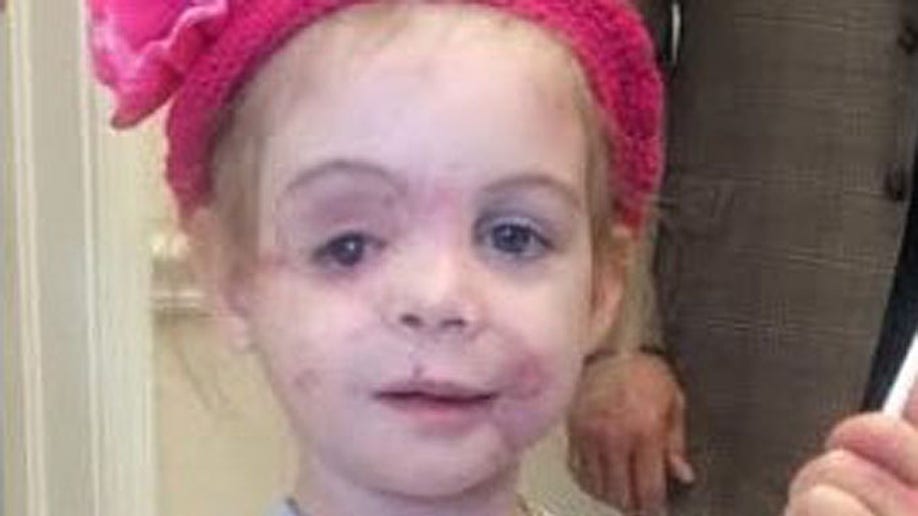 Docs Join To Help Girl Attacked By Dogs After Kfc Hoax Accusations
