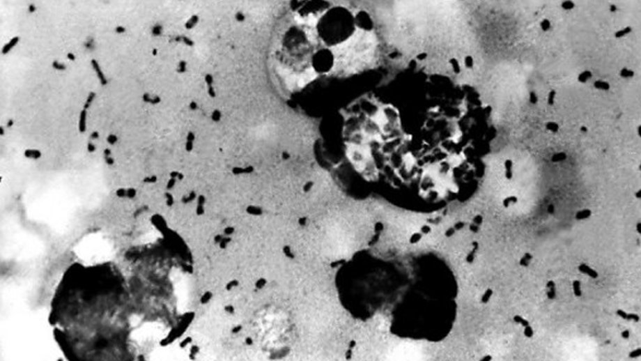 China reports suspected case of bubonic plague in Inner Mongolia