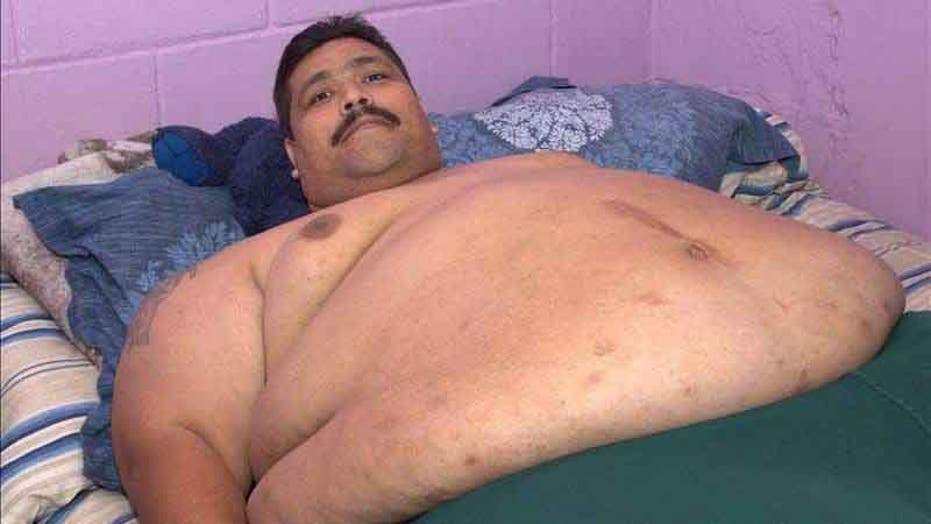 At nearly 1000 lbs. world s heaviest man to undergo weight loss surgery in Mexico Fox News