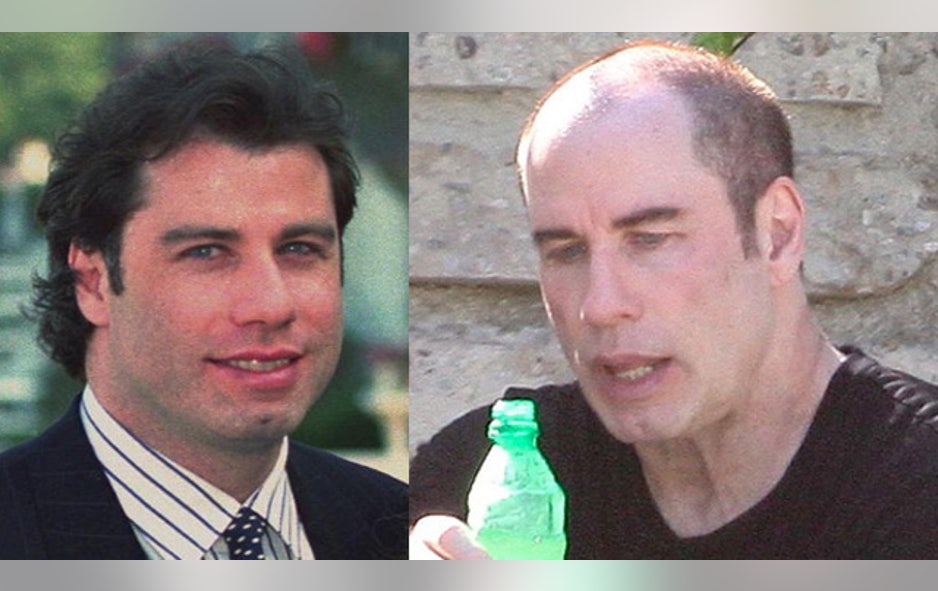 Hair Today Gone Tomorrow Hollywood Stars Going Bald Fox News