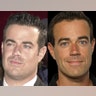 Carson Daly