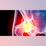 Bone Health