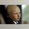 Minnesota Boy Flees Chemo Treatments